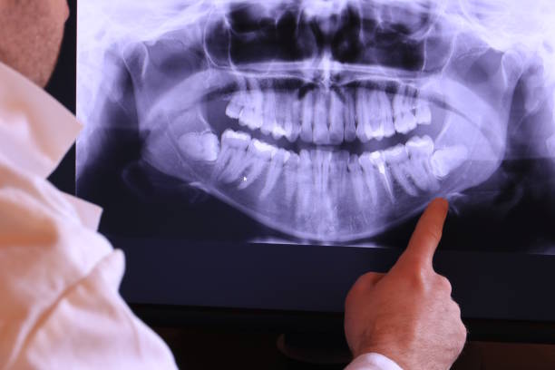 Best Emergency Treatment for Toothache in Auburn, ME
