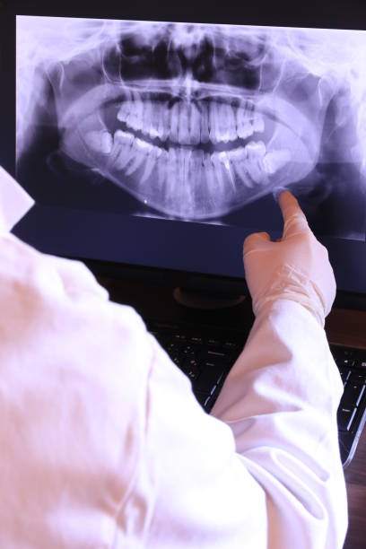 Best Emergency Root Canal Treatment in Auburn, ME